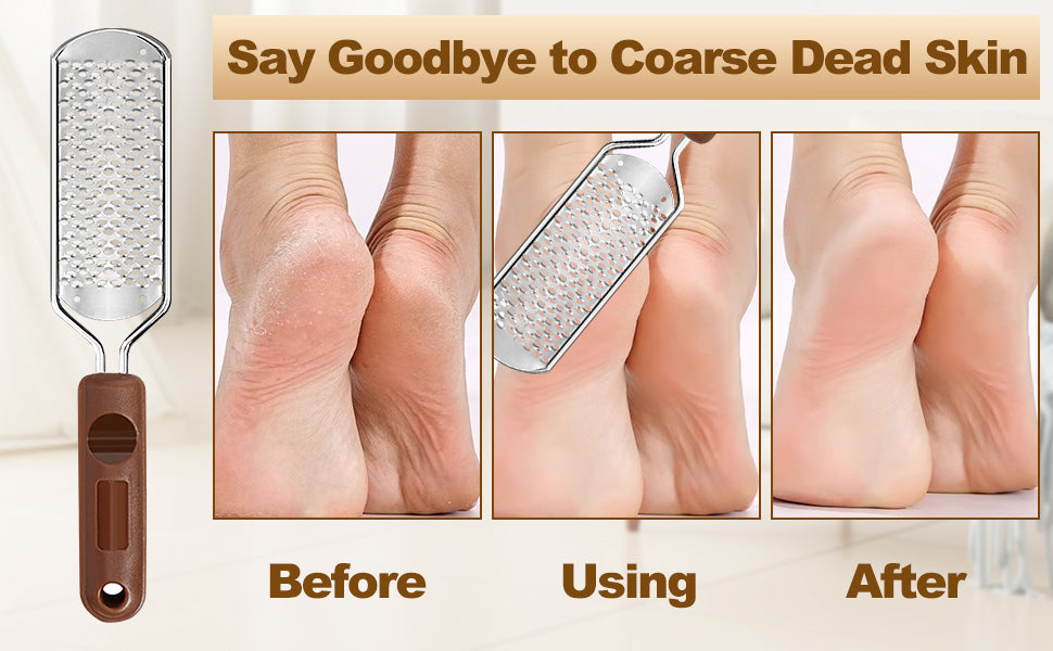 MERKEL CALLUS SHAVER - FOOT FILE