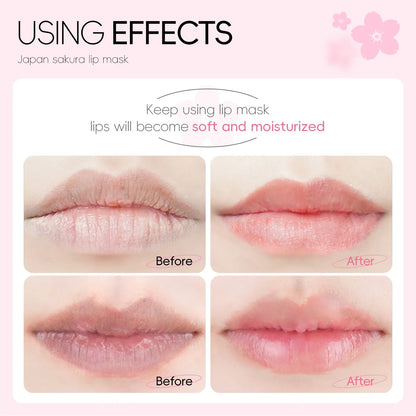 LAIKOU 5/10pcs Lip Mask Lip Care Moisturizing Hydrating Repair Lighten Lip Lines Labial Gel Patch Lips Pad Patches Care Products