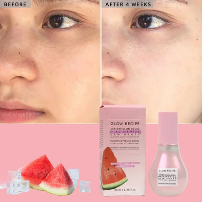 Glow Recipe Watermelon Glow Niacinamide Dew Drops - Makeup Primer, Pore Minimizer & Niacinamide Serum for Dewy Smooth Skin 40ml