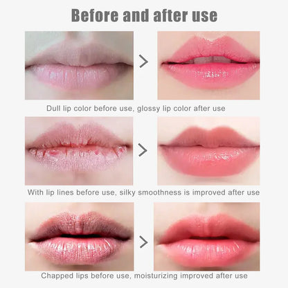 EELHOE Cherry Nourishing Lip Mask Fade Lip Lines Improve Dry Repair Cracks Smoothing Lip Patches Moisturizing Skincare Mask 5pcs