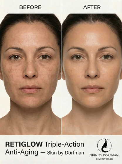 Retiglow